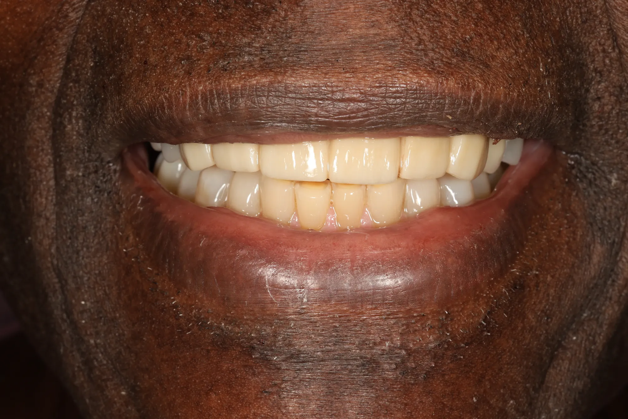 True-to-You Smile Tones