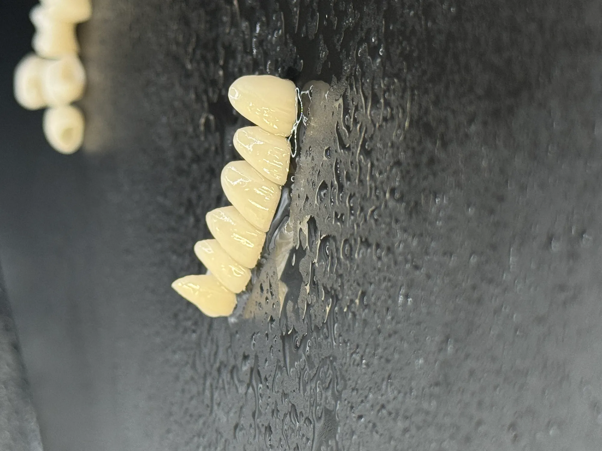 Minimally Invasive Ceramic Restorations